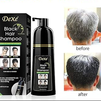 Champú tinte negro 2 en 1 – Elimina Canas al instante